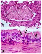 <b>Distemper in Cats</b>